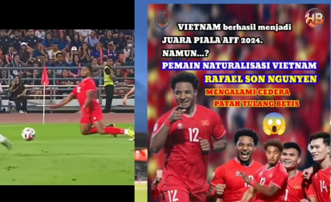 Nguyen Xuan Son Cedera, Patah Tulang Betis, Vietnam Jadi Raja Asean 2024, Final Piala AFF 2024