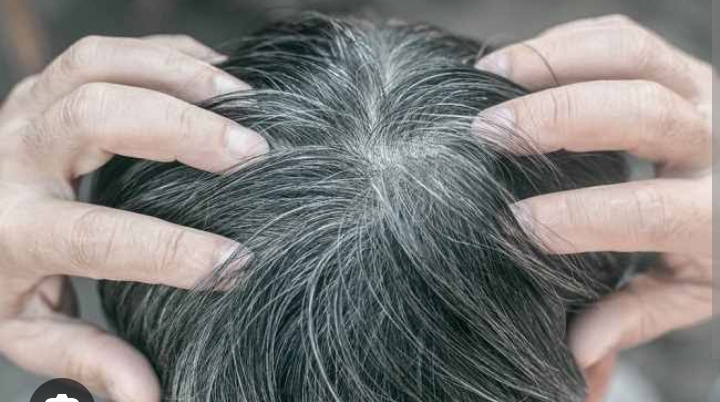 Cara Cepat Kembalikan Rambut Ubanan agar Kembali Hitam Bercahaya