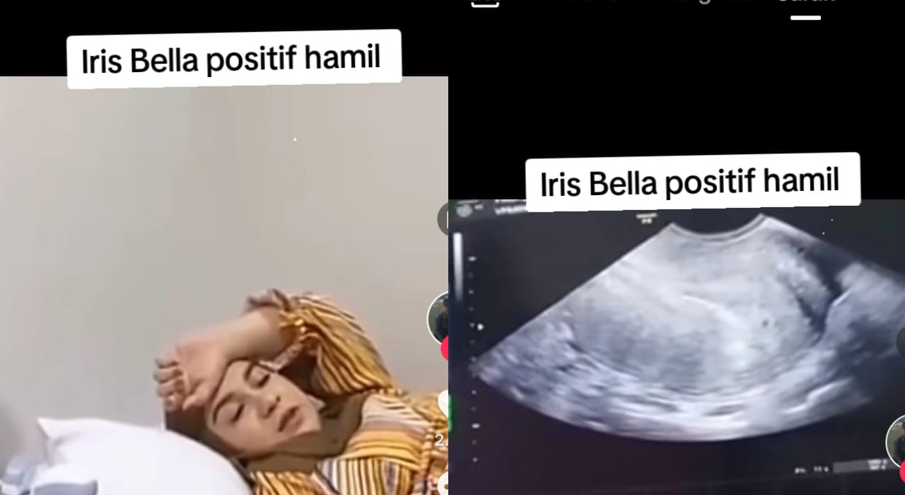 Irish Bella Hamil Kembar, Orang Aceh Perkasa, Haldy Sabri, Garis Dua, Selebriti Indonesia