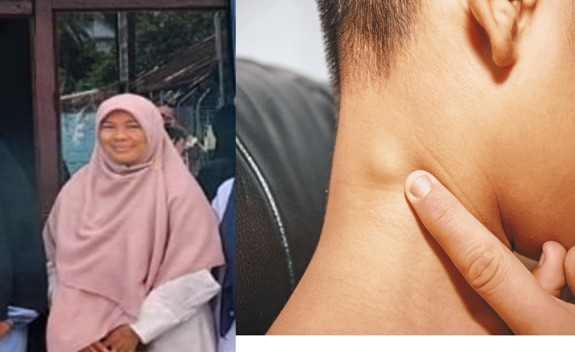 DETEKSI DINI TANDA DAN GEJALA KANKER PADA TUBUH