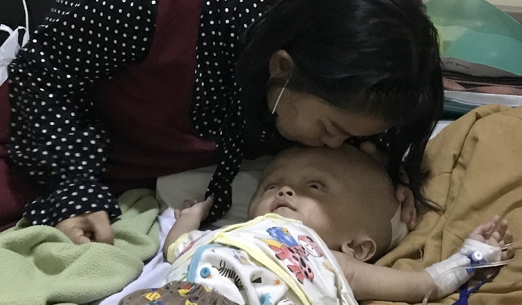 Anak ini Menderita Hidrosefalus Netizen Open Donasi