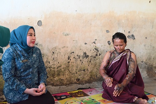 Lidyawati Cik Ujang Jenguk Yunita, Korban Penyiraman Cuka Para