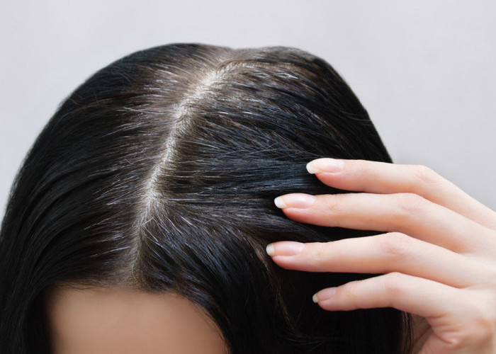 Mencegah Uban Muncul Lebih Cepat, Tips Merawat Rambut Dengan Cara Sederhana ini