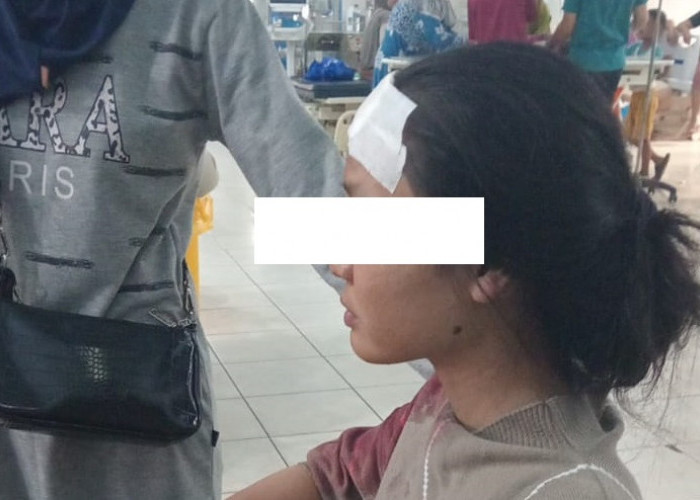 Kening Mahasiswi UT Lahat Luka Robek 5 Jahitan, Lagi Naik Motor Kena Pukulan Benda Tumpul oleh Begal