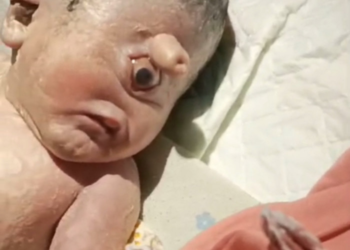 Bayi Mata Satu Lahir di Sekayu Musi Banyuasin Sumsel