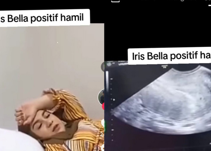 Irish Bella Hamil Kembar, Orang Aceh Perkasa, Haldy Sabri, Garis Dua, Selebriti Indonesia